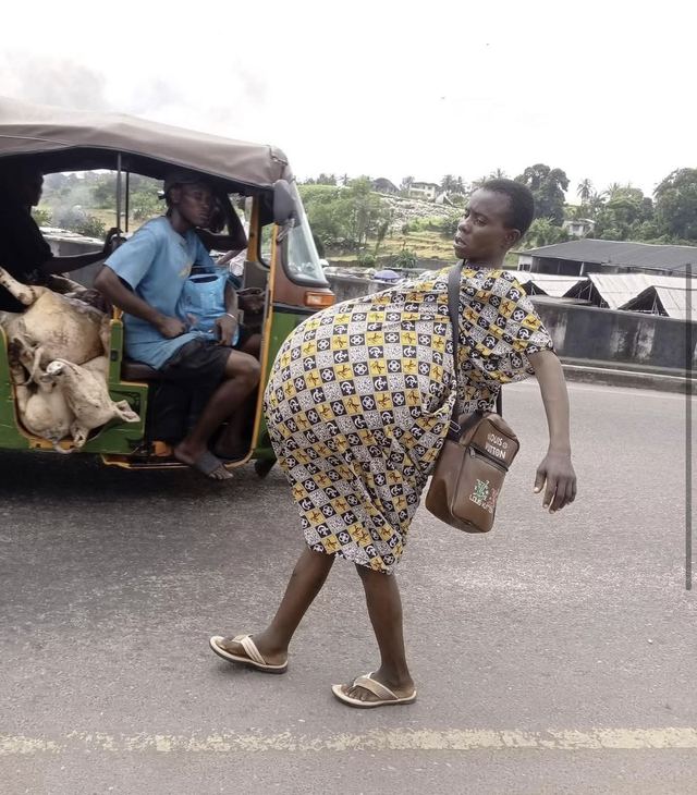 A woman in a yellow and black print dress, her body visibly swollen, crosses a road beside a tricycle